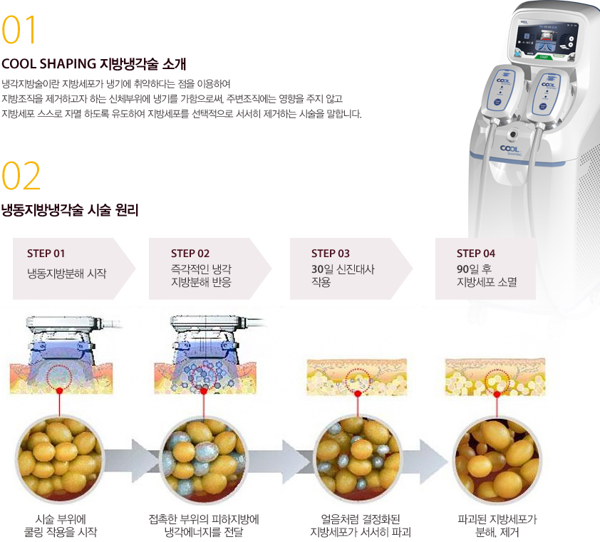 COOL SHAPING 지방냉각술 소개